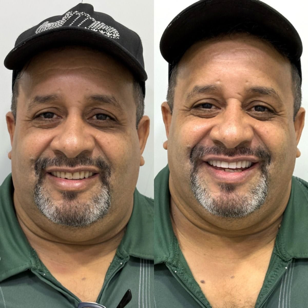 Resultado de tratamento — antes e depois